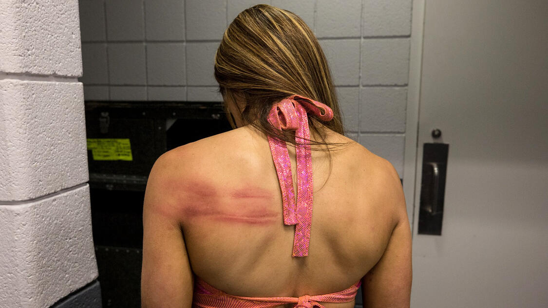 Alexa Bliss Kendo Stick Attack Leaves Marks On Mickie James Back Wwe 8415